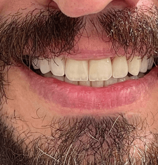After
